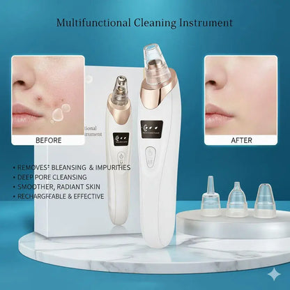 Rechargeable Vacuum Pore Cleaner, 5 In 1 Blackheads Removing Device Electric Derma Suction Machines